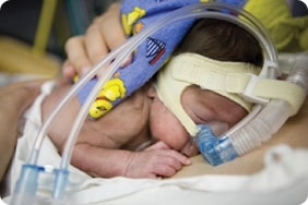 baby with medical apparatus